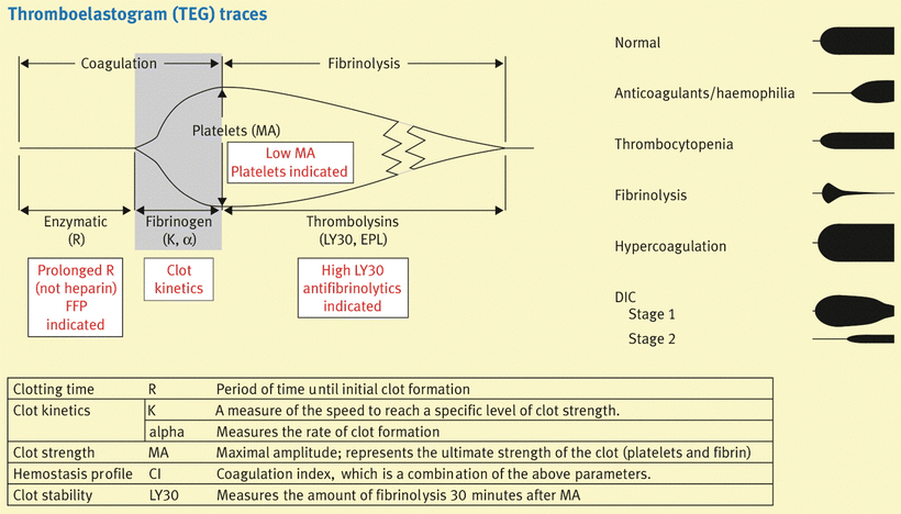 A312535_1_En_36_Fig6_HTML.gif