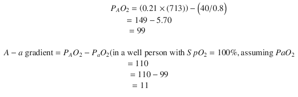 
$$ \begin{array}{c}\kern4.5em {P}_A{O}_2=\left(0.21\times (713)\right)-\Big(40/0.8\Big)\\ {}\begin{array}{l}=149-5.70\\ {}=99\end{array}\\ {}\\ {} A- a\ \mathrm{gradient}={P}_A{O}_2-{P}_a{O}_2(\mathrm{in}\ \mathrm{a}\ \mathrm{well}\;\mathrm{person}\;\mathrm{with}\ Sp{O}_2=100\%,\mathrm{assuming}\ Pa{O}_2\\ {}\begin{array}{l}=110\hfill \\ {}\begin{array}{l}=110-99\hfill \\ {}=11\hfill \end{array}\hfill \end{array}\end{array} $$
