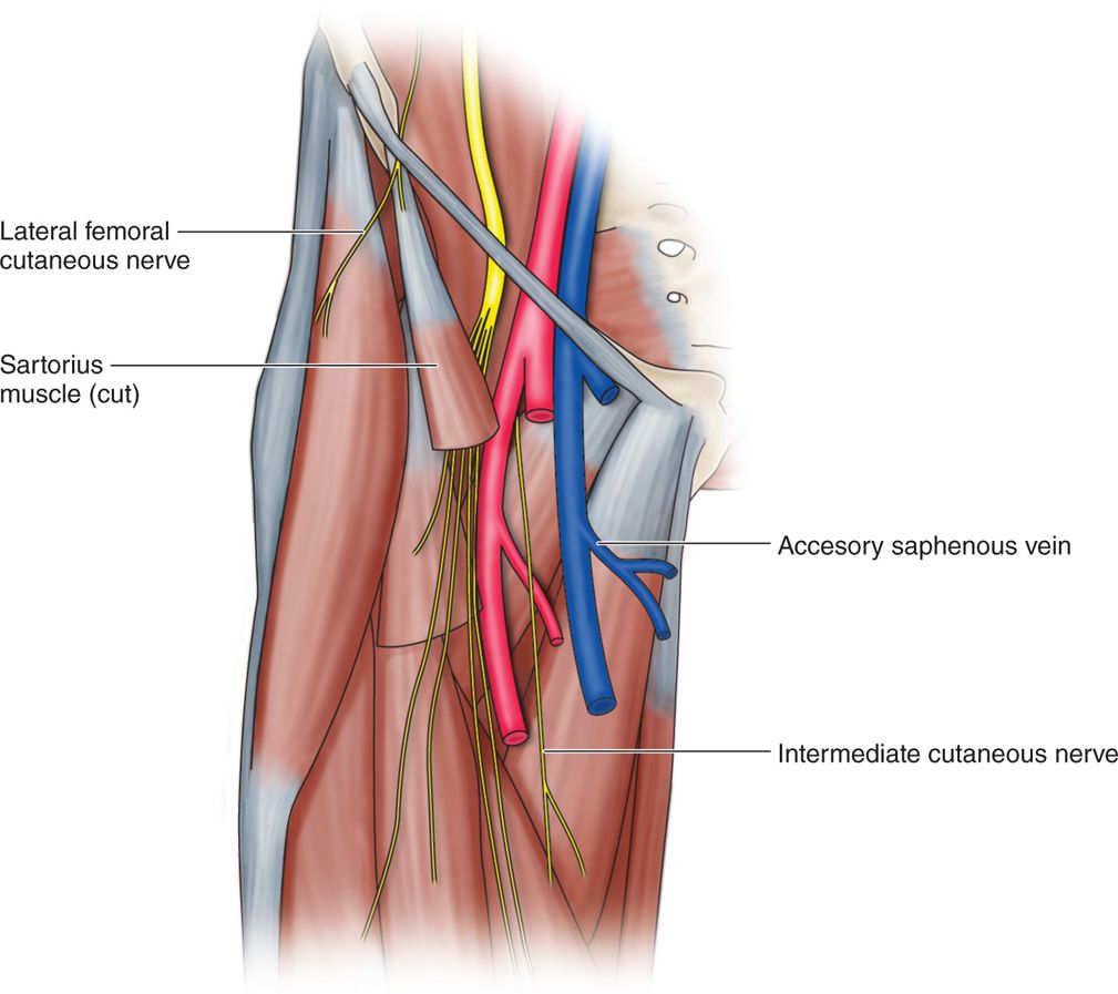 Lateral Femoral Cutaneous Nerve Block Anesthesia Key