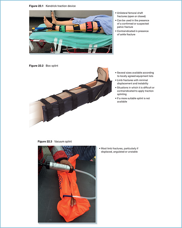 Diagram shows box splint with markings for several sizes available according to locally agreed equipment lists, if more suitable splint is not available, et cetera.