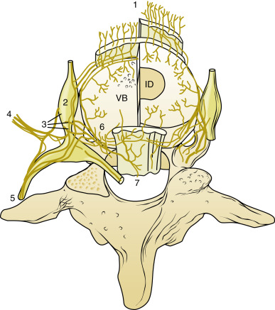 Lumbar Discogenic Pain And Diskography | Anesthesia Key