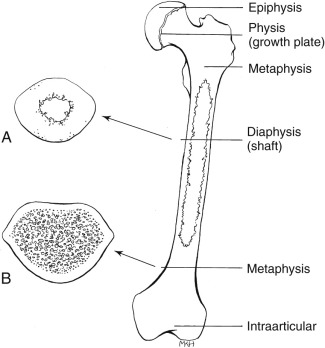 General Principles Of Fracture Care | Anesthesia Key