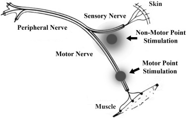 Neuromuscular Electrical Stimulation In Critically Ill Patients ...