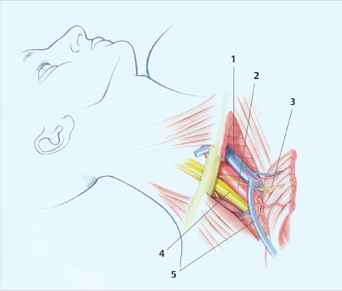 4 Supraclavicular And Infraclavicular Techniques Of Brachial Plexus ...