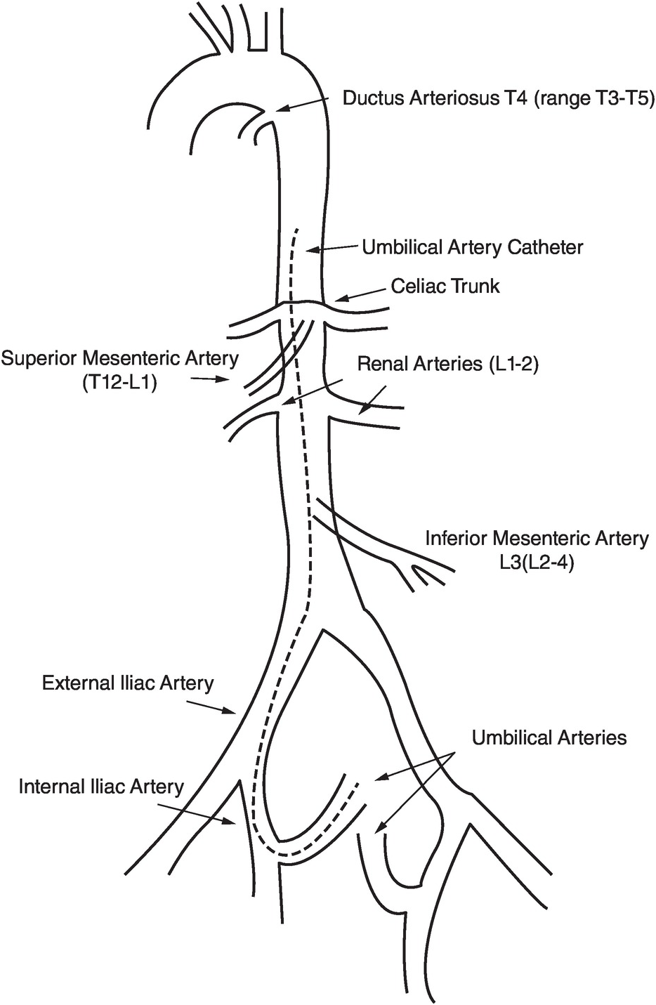 Chapter 8 – Monitoring of the Pediatric Patient | Anesthesia Key