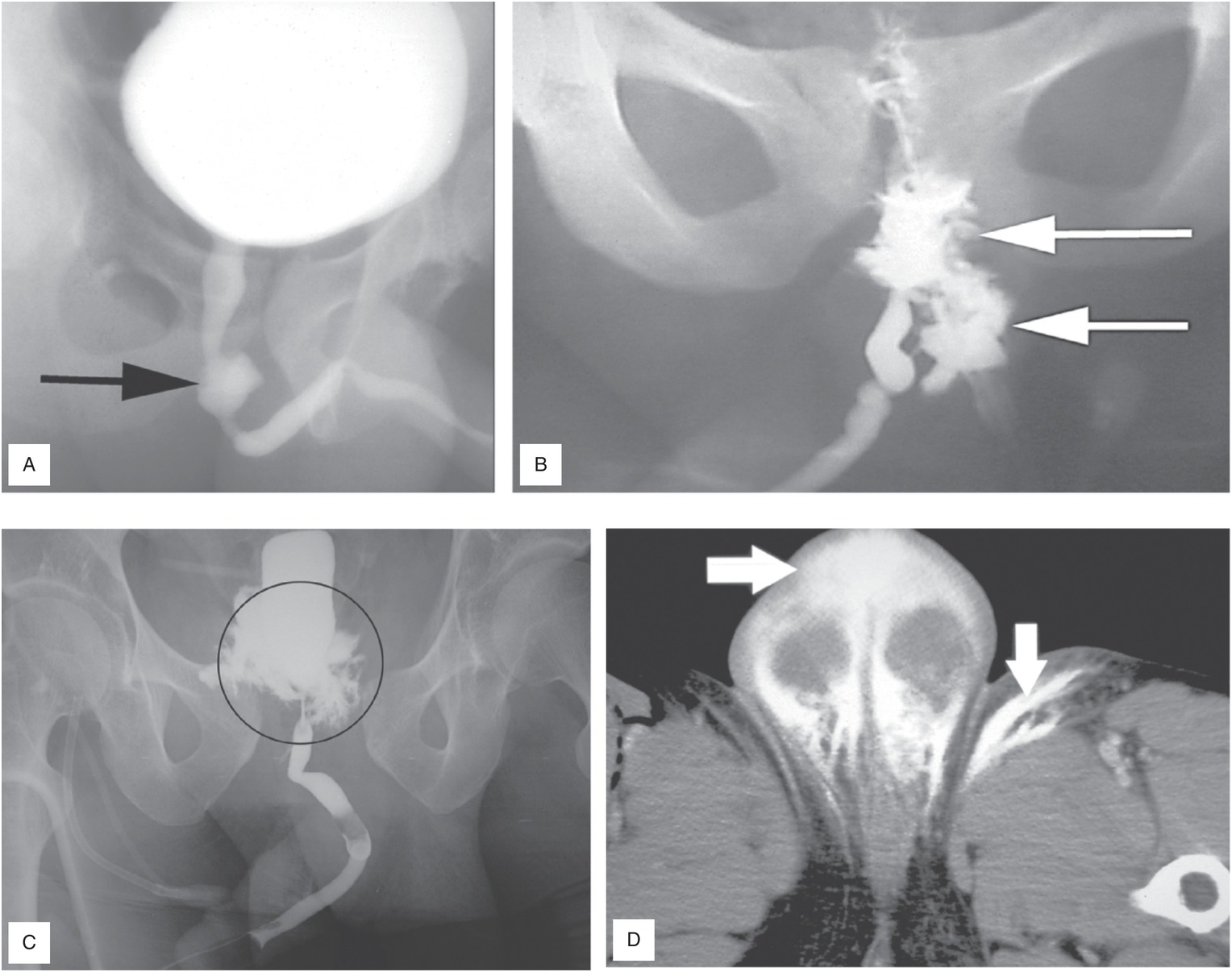 Chapter 16 – Genitourinary Trauma | Anesthesia Key