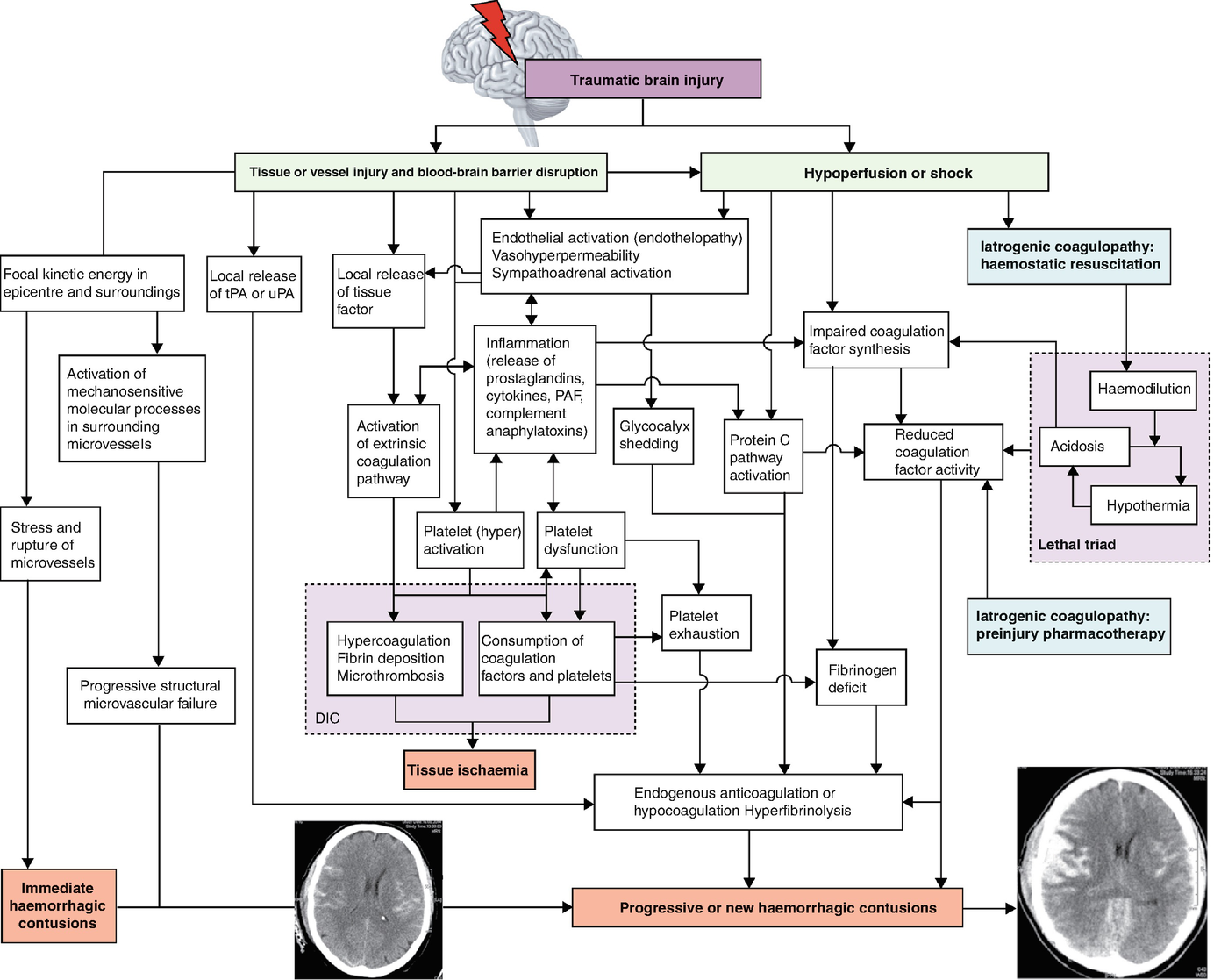 Control Resuscitation For Severe Traumatic Brain Injury | Anesthesia Key