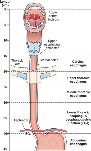 Esophageal Procedures | Anesthesia Key