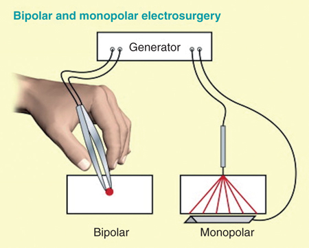 Surgical Instruments | Anesthesia Key