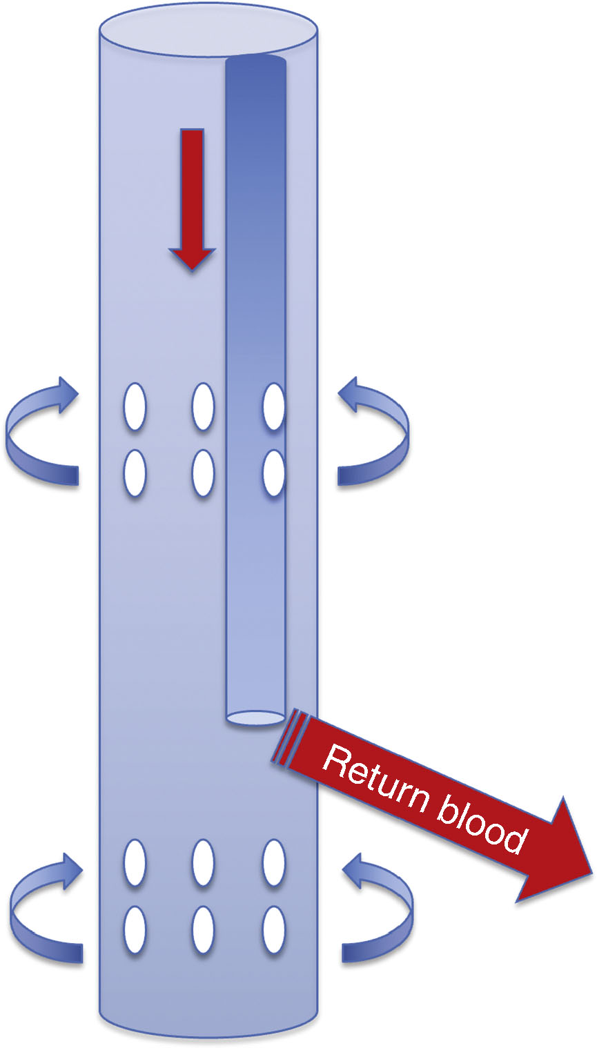 ECMO Configurations | Anesthesia Key