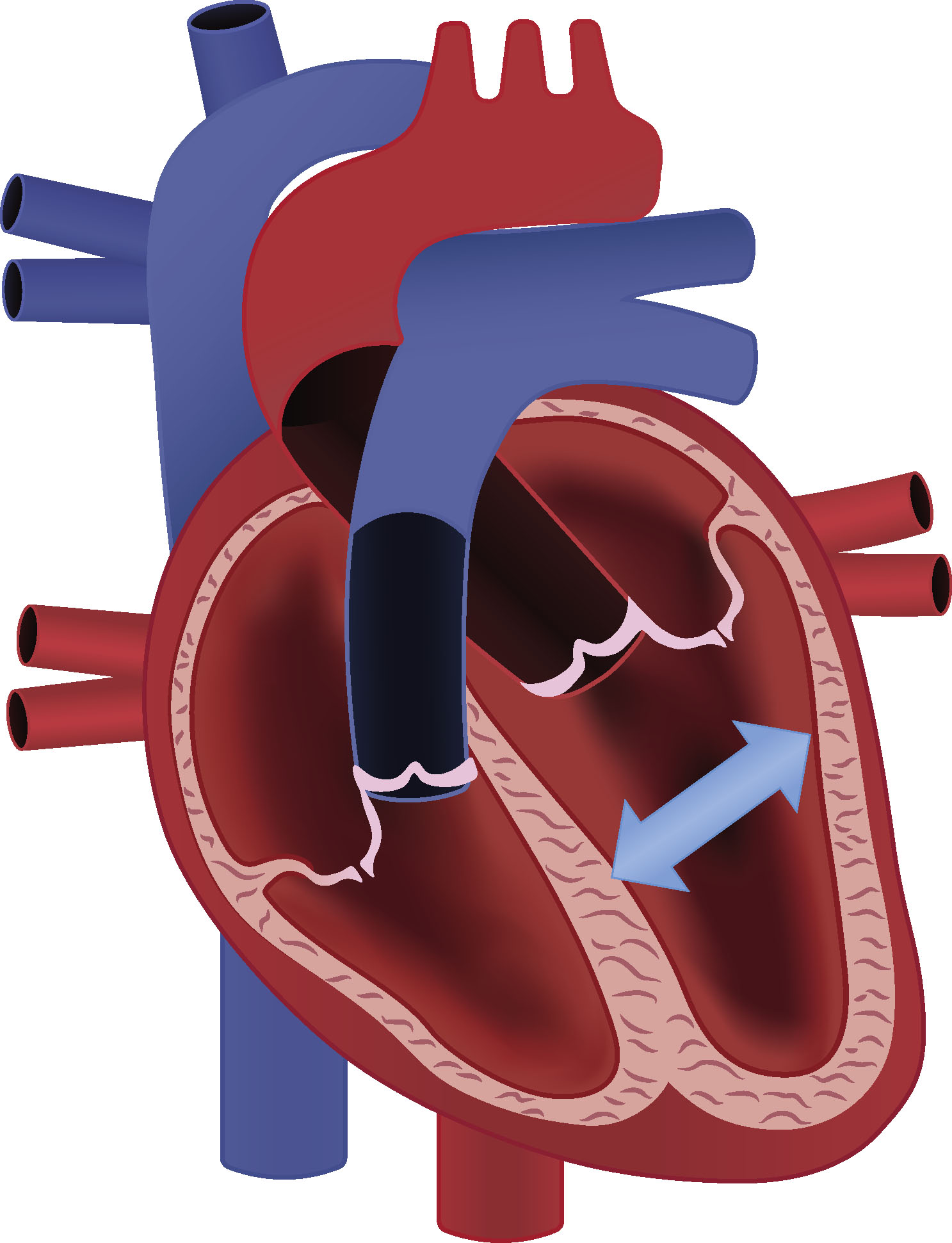 Veno-Arterial ECMO Physiology | Anesthesia Key