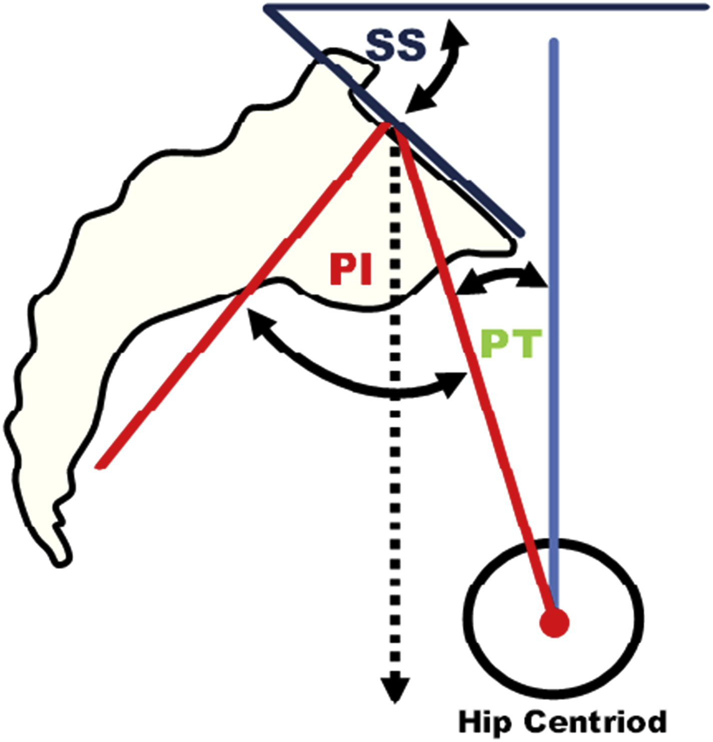 Spinal Alignment Anesthesia Key