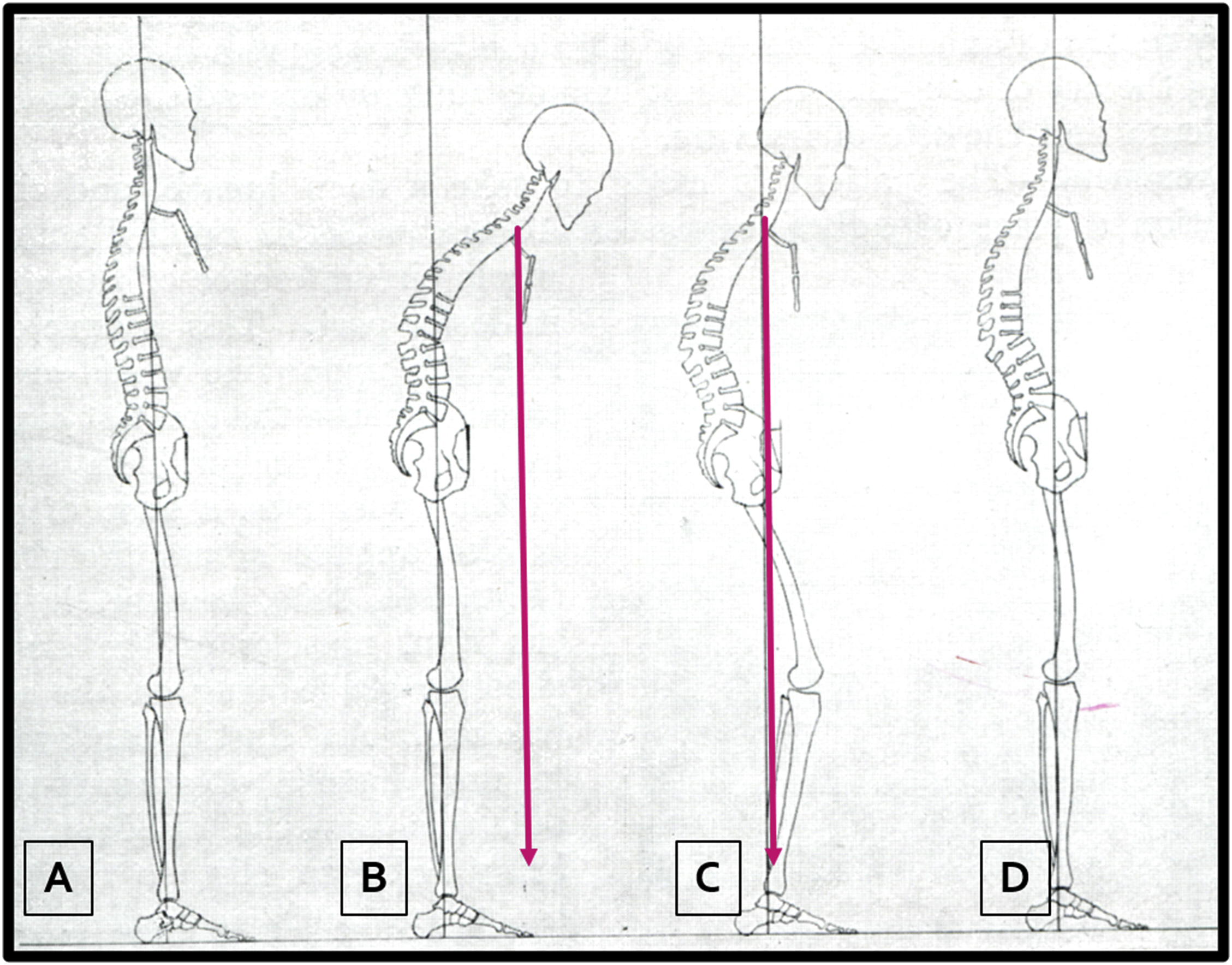 Spinal Alignment Anesthesia Key