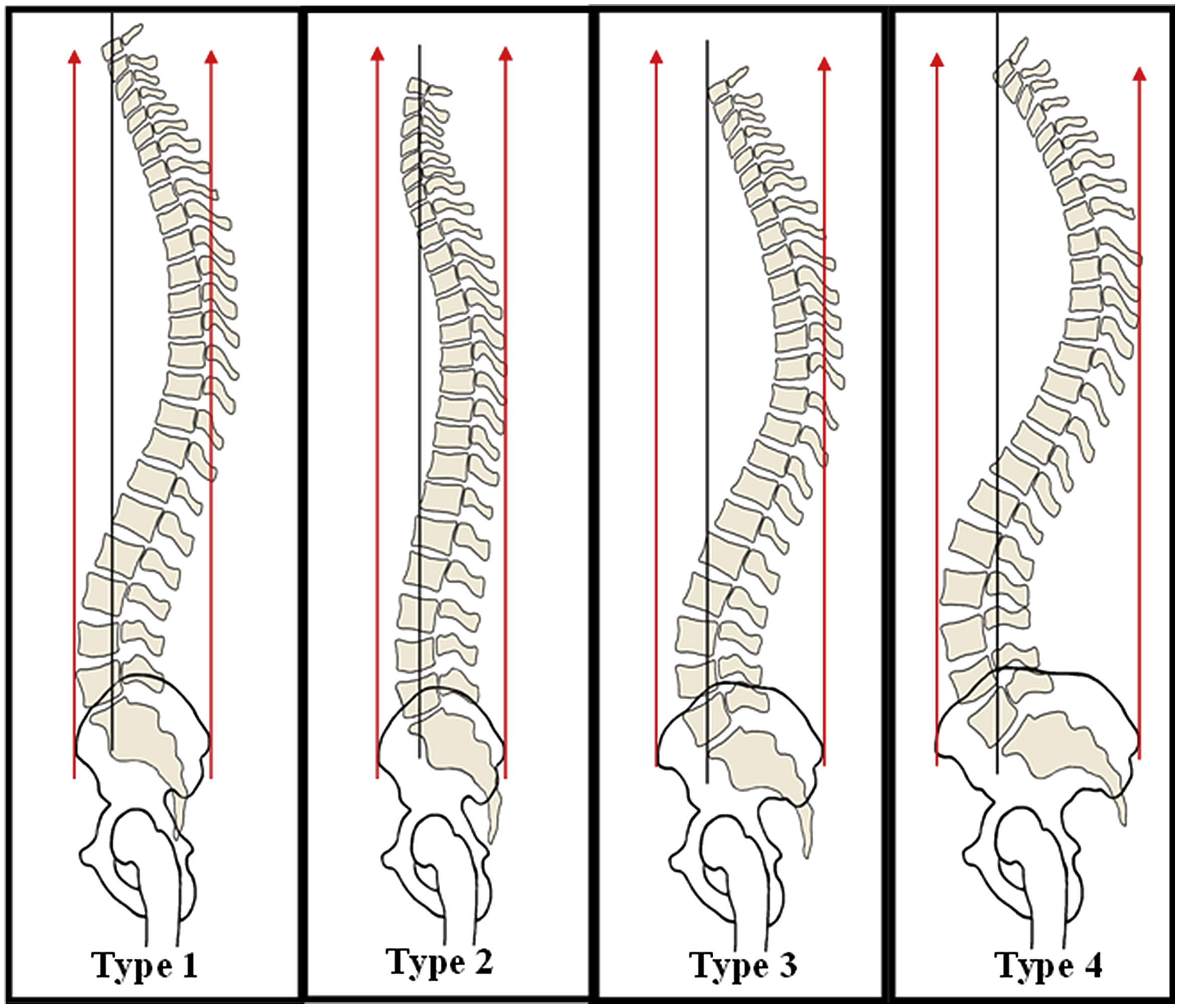 Spinal Alignment Anesthesia Key