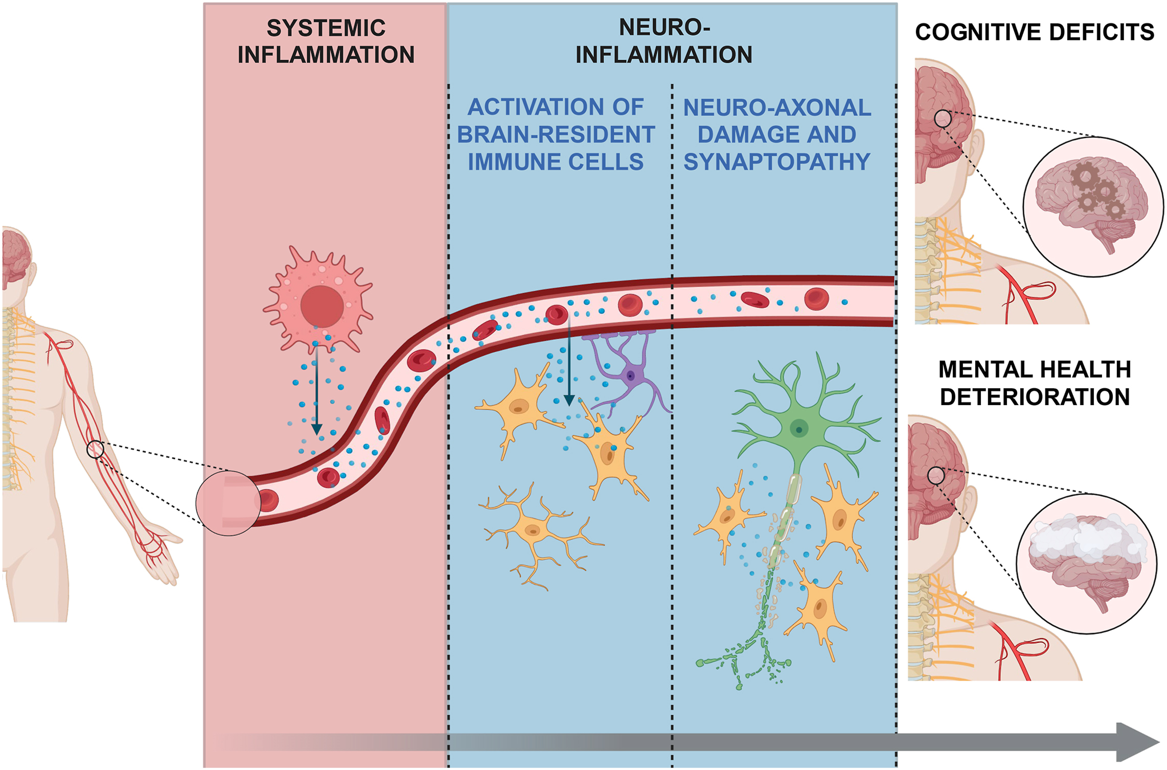 Alt text begins. A schematic diagram shows systemic inflammation progressing to neuroinflammation, neuro-axonal injury, cognitive deficits, and mental health deterioration. Alt text provided by Elsevier.