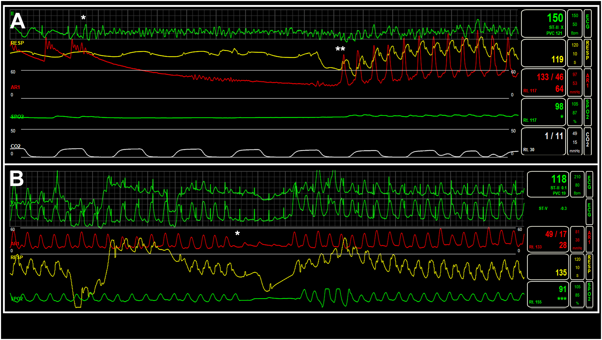 Two panels depict a medical monitor displaying waveforms with color-coded vital signs.