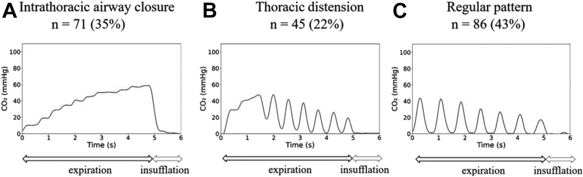 A set of three line graphs labeled A to C comparing carbon dioxide levels over time during expiration and insufflation in different breathing patterns.