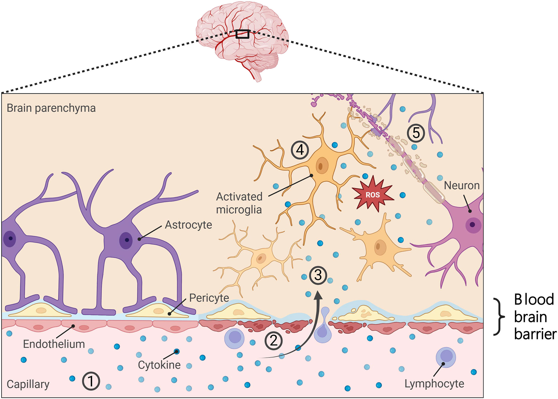 Alt text begins. A blood-brain barrier diagram shows cytokine entry, activated microglia and astrocytes, reactive oxygen species, and neuronal damage during inflammation. Alt text provided by Elsevier.