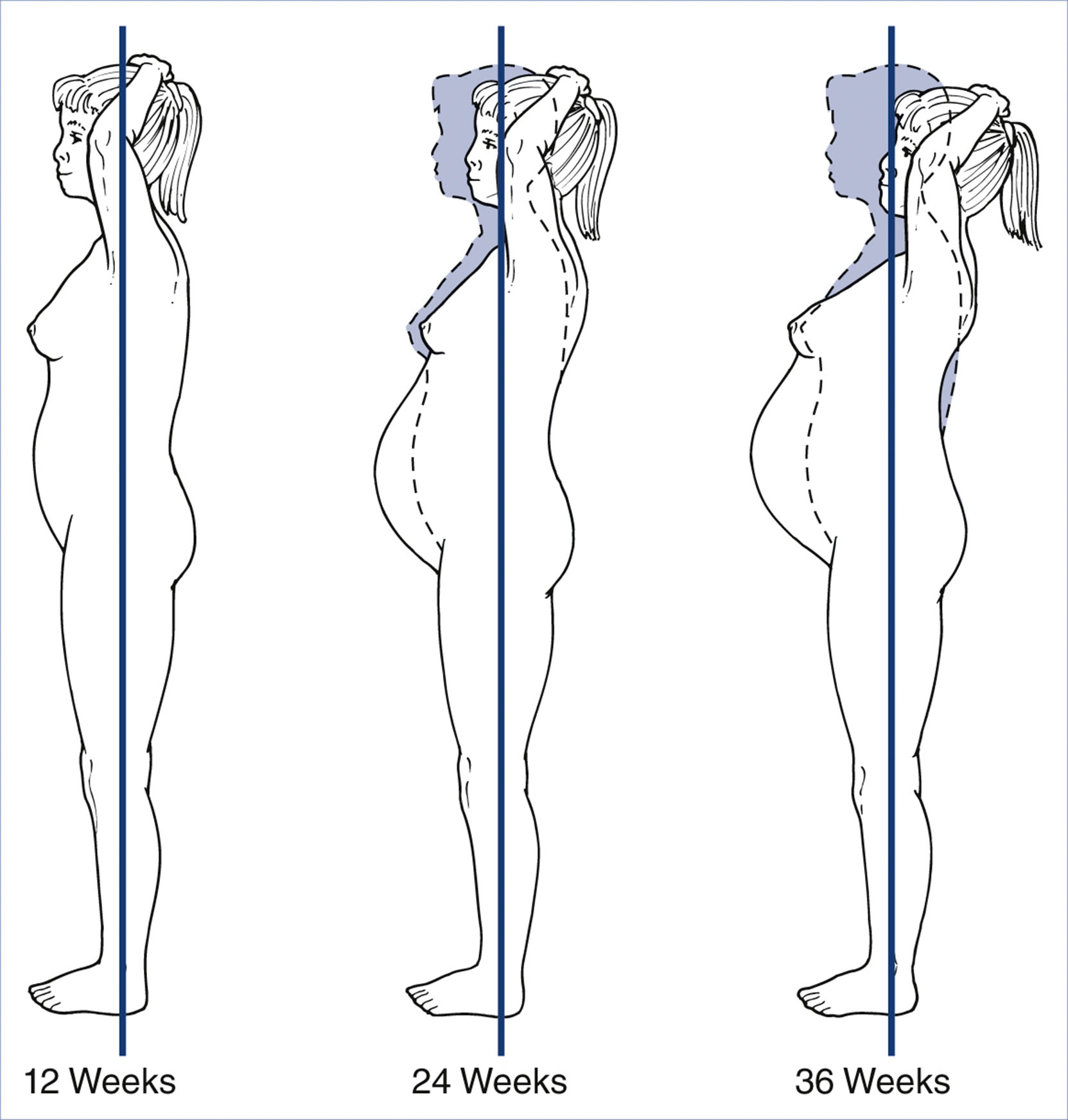 An illustration shows changes in a woman’s posture at 12, 24, and 36 weeks of pregnancy, with increasing abdominal protrusion and spinal curvature.