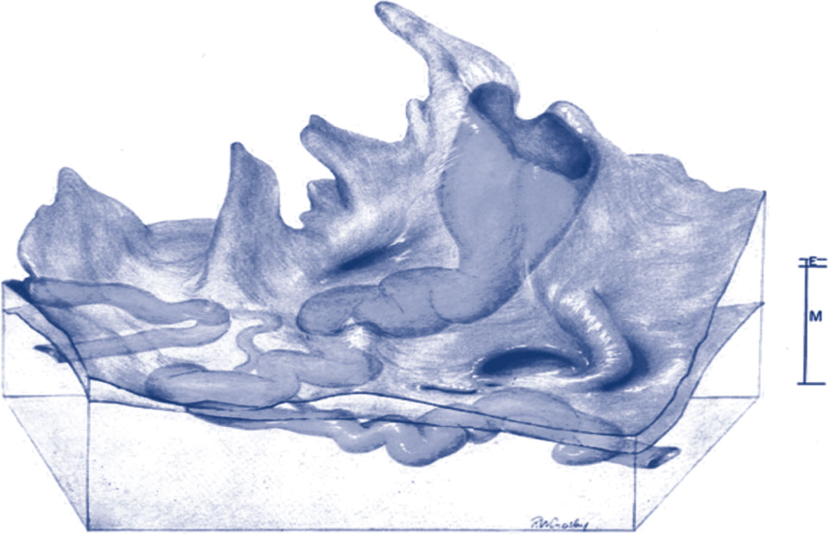 A three-dimensional reconstruction shows a uterine spiral artery passing through the myometrium, endometrium, and basal plate into the intervillous space.