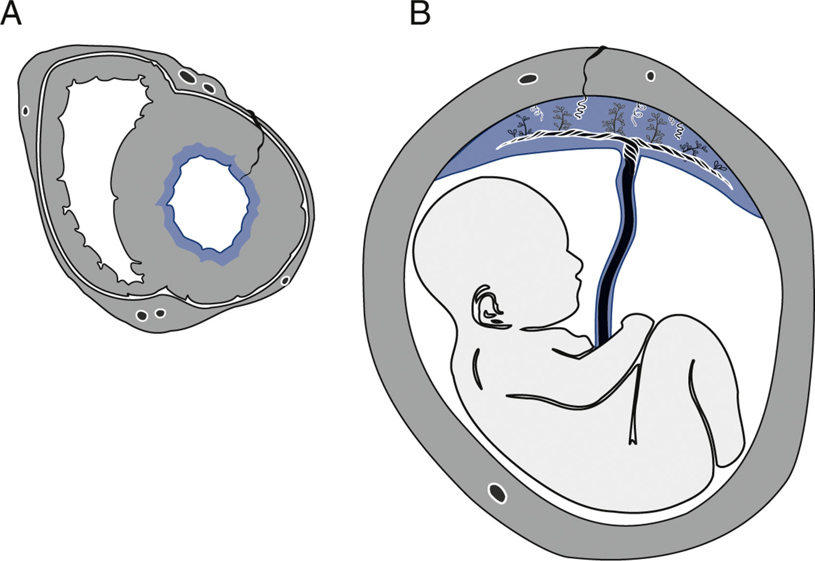 A cross-sectional diagram compares subendocardial and placental perfusion, with areas marking tissue at risk and lines indicating blood supply.