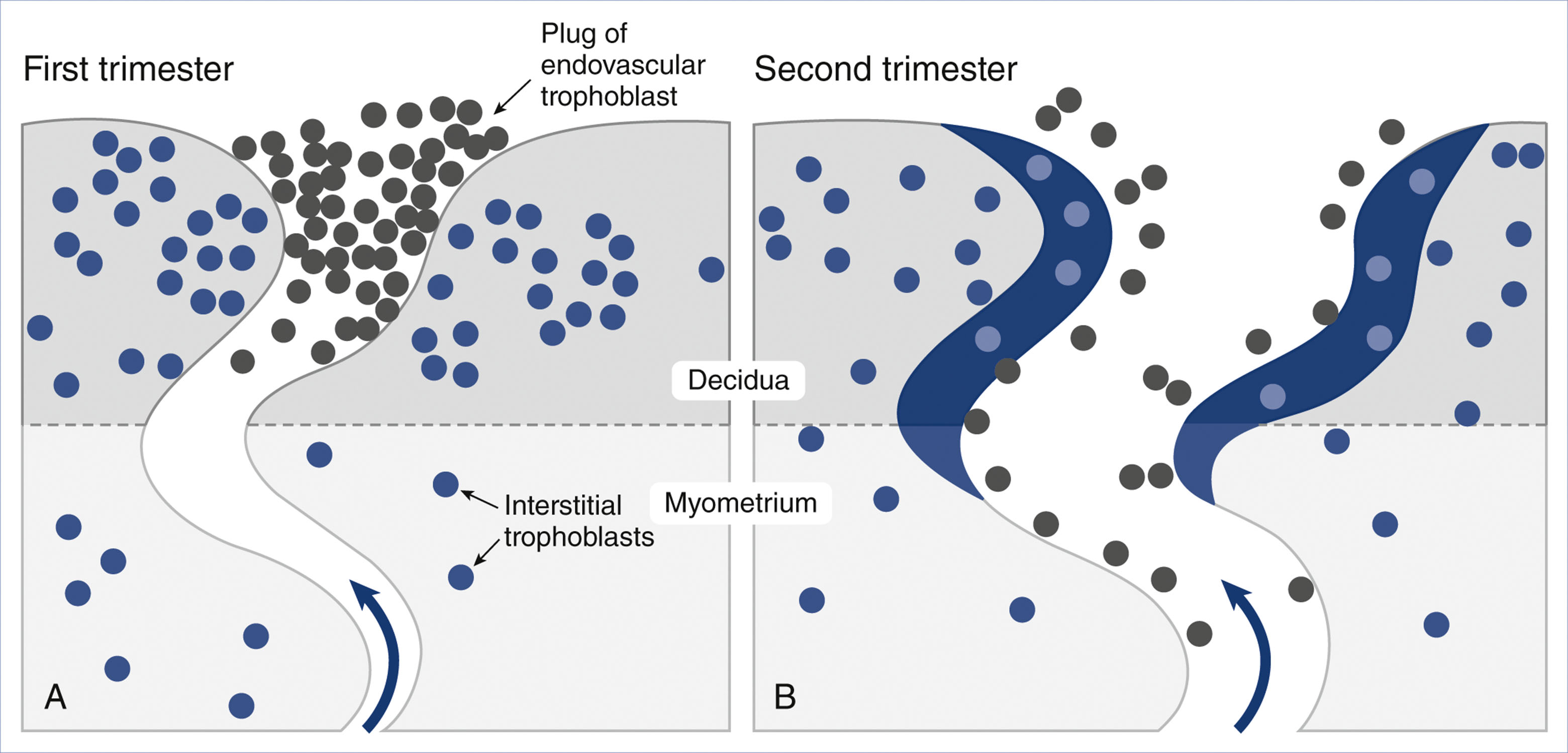 A two-panel illustration shows spiral artery plugging by trophoblasts in the first trimester and artery remodeling with blood flow in the second trimester.