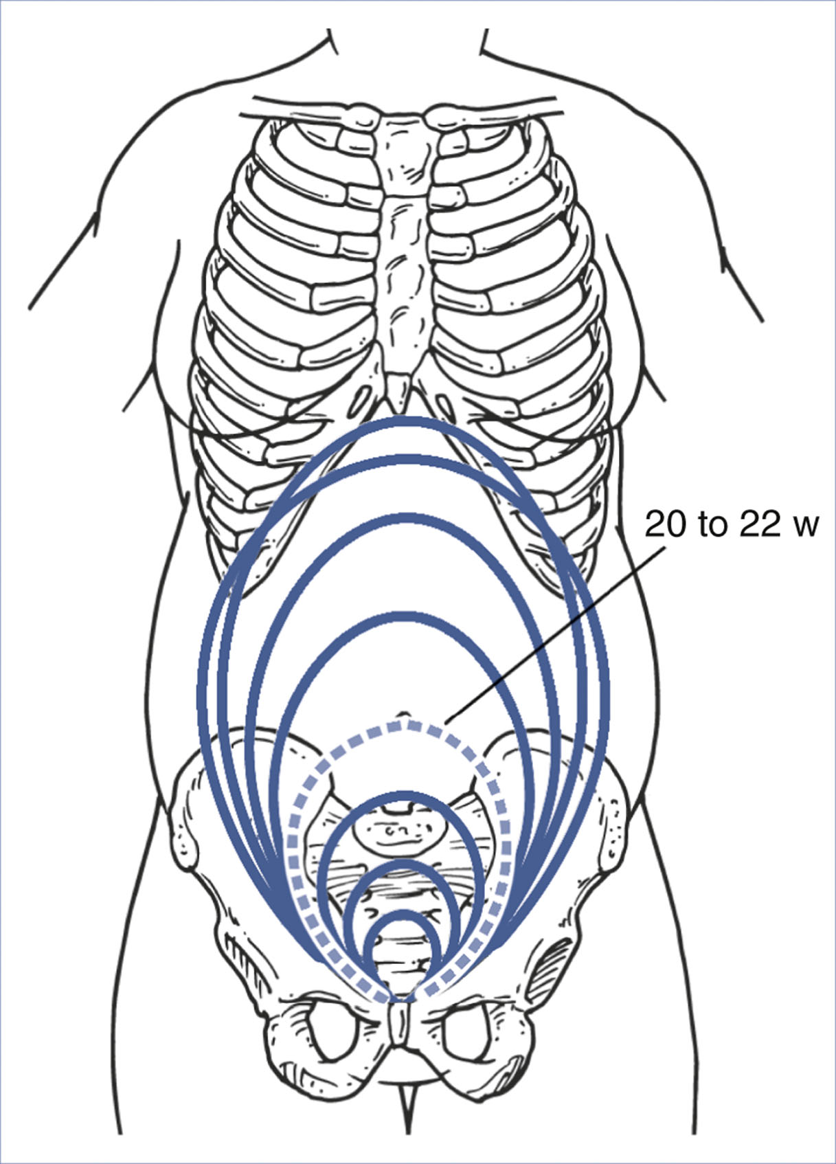 An illustration of a female torso shows curved lines marking the uterine fundal height at different pregnancy stages, with the arc labeled 20 to 22 weeks reaching the level of the maternal umbilicus.