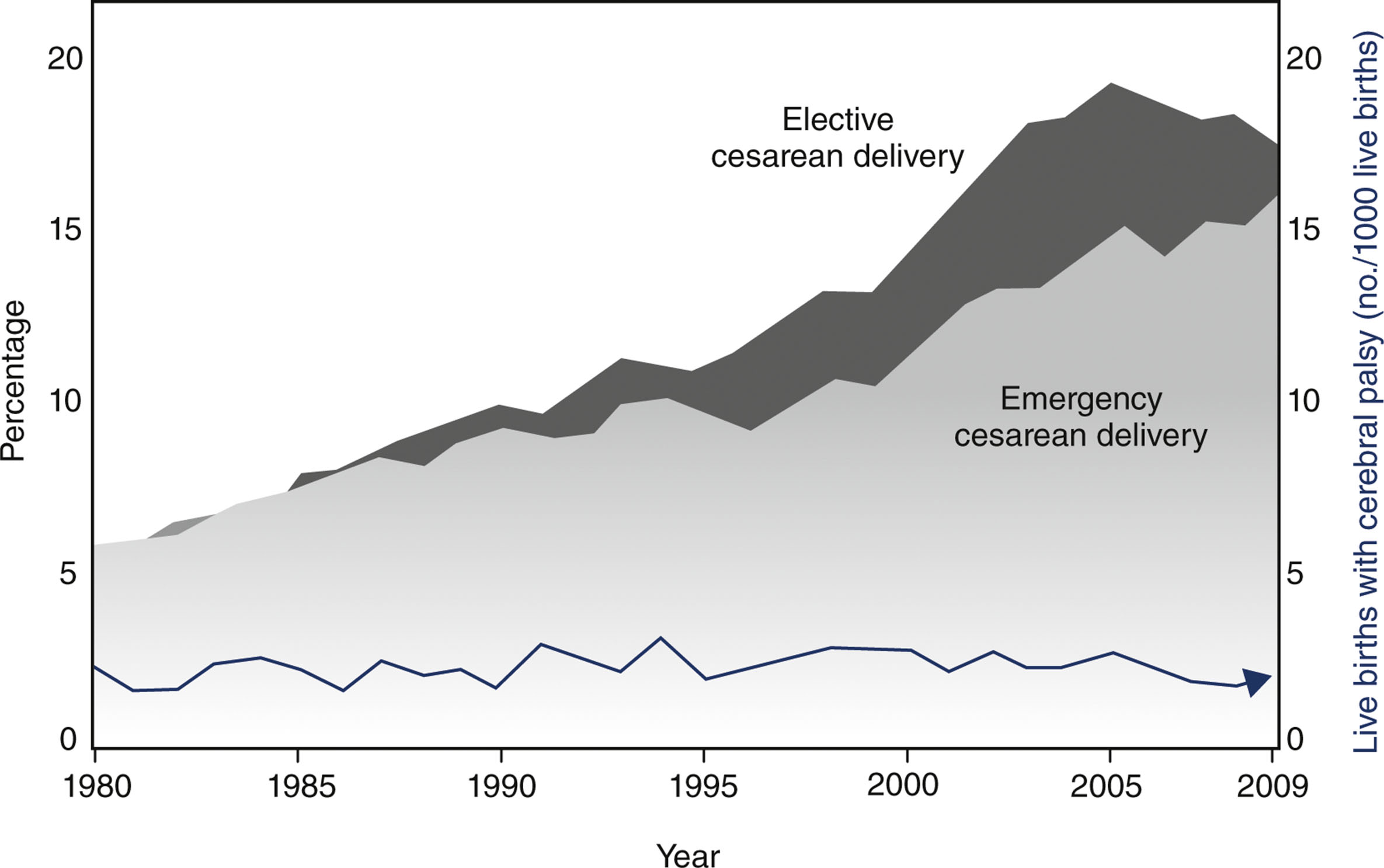 A dual-axis graph presents trends in cesarean delivery types and live births with cerebral palsy from 1980 to 2009.