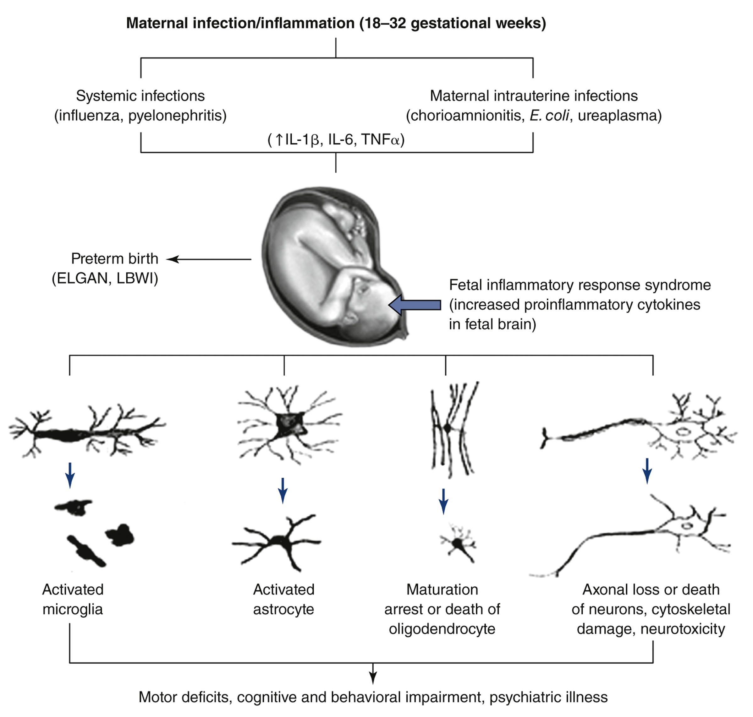 A diagram shows fetal brain injury mechanisms resulting from maternal infection or inflammation.