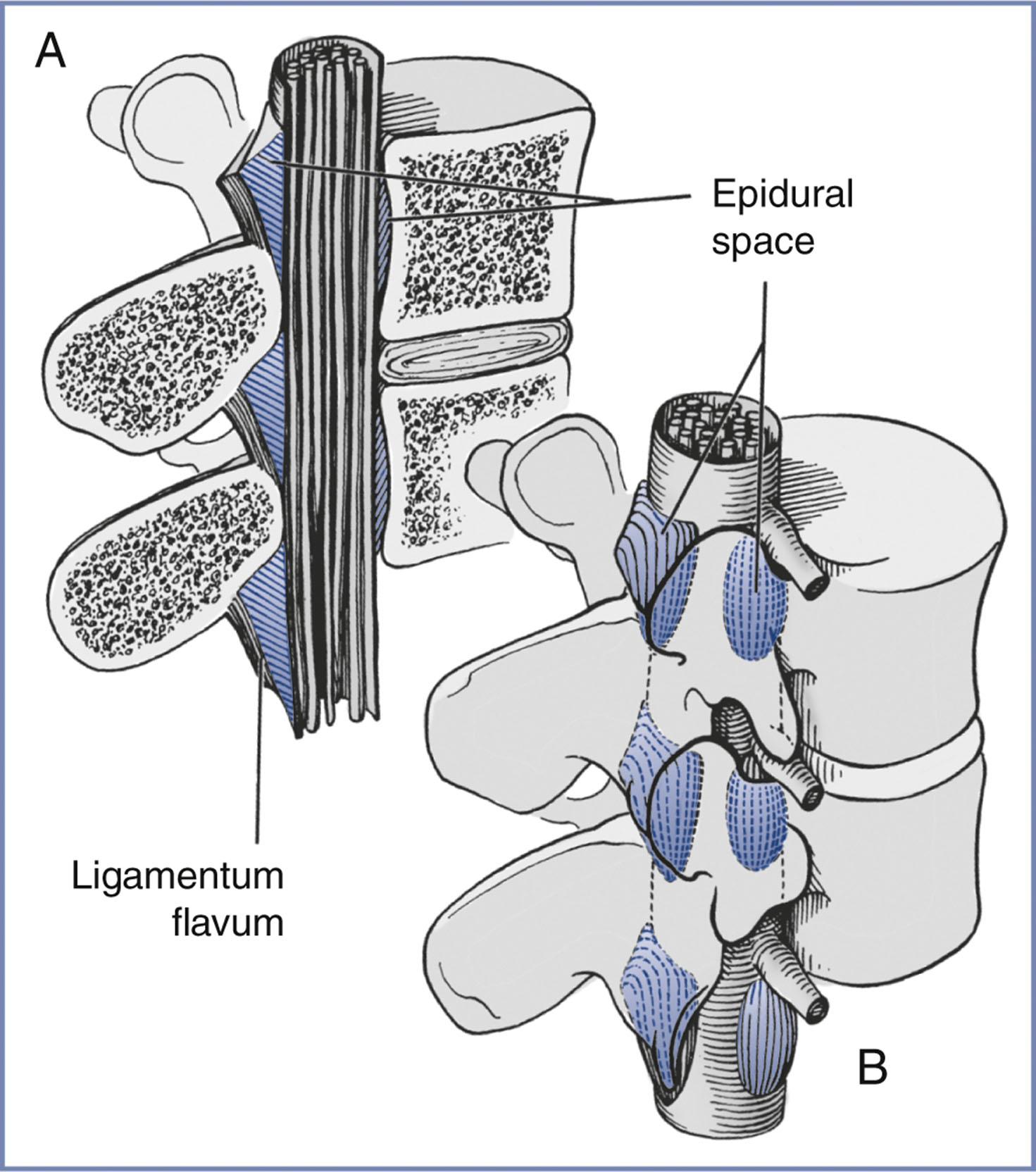 An anatomical diagram presents the epidural space in sagittal and three dimensional views.