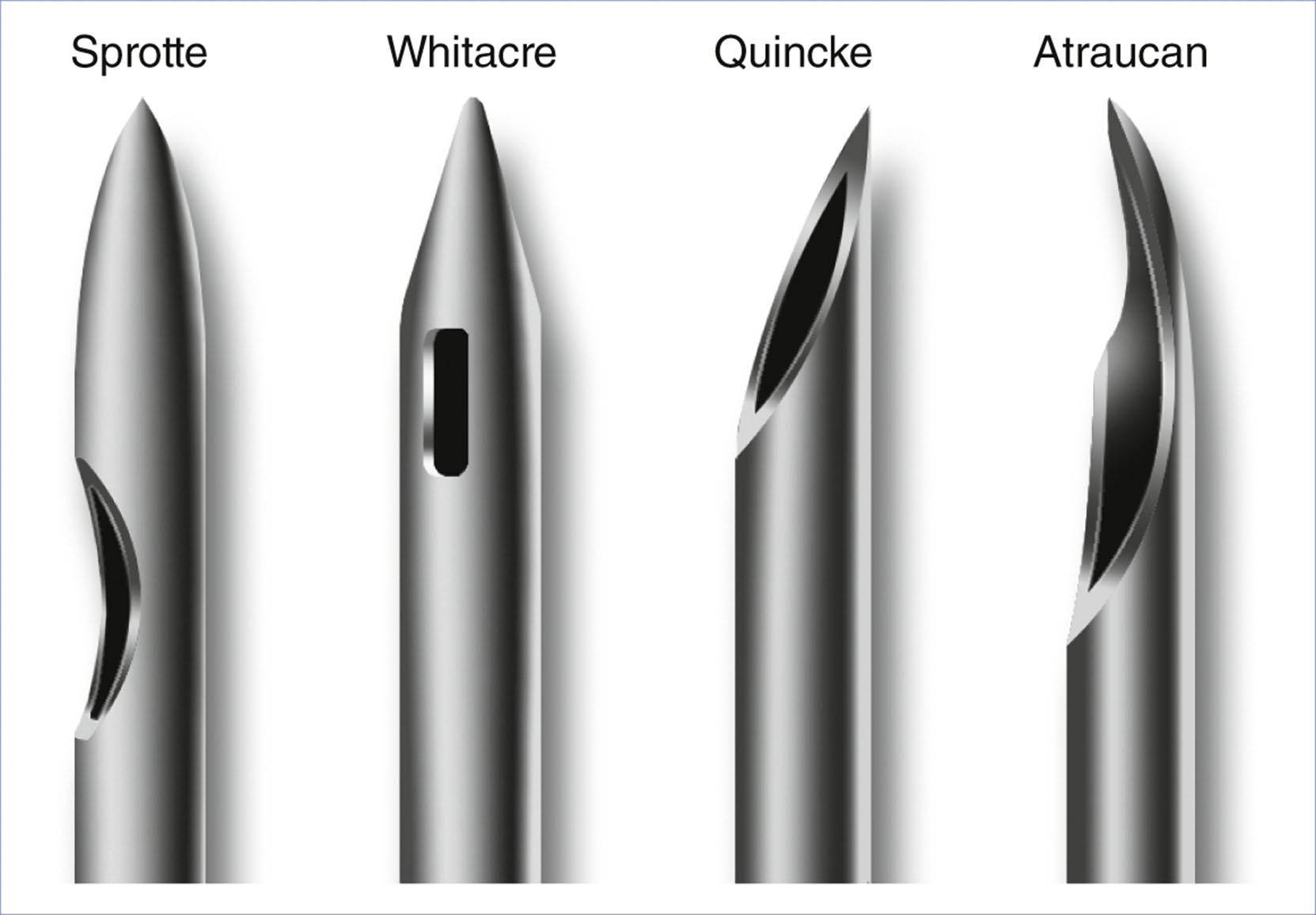 An anatomical diagram presents four spinal needle types labeled Sprotte, Whitacre, Quincke, and Atraucan.