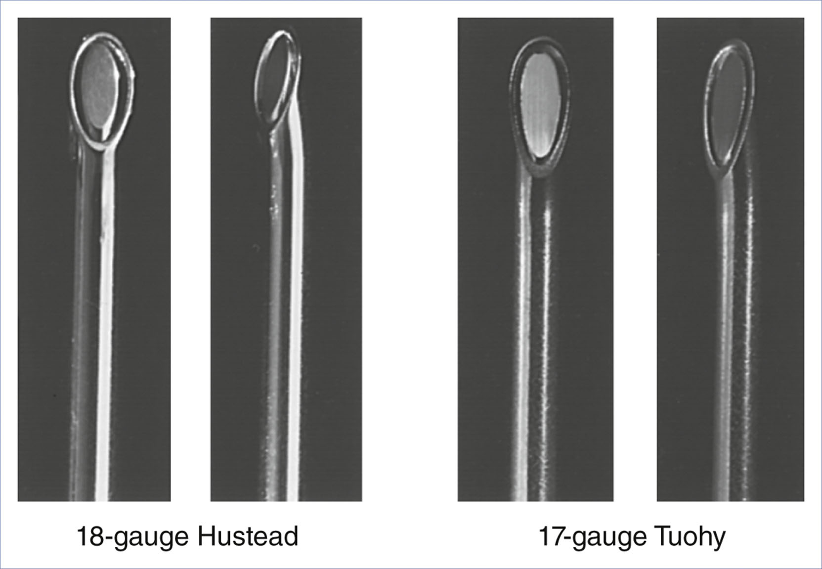 An anatomical diagram presents 18 gauge Hustead and 17 gauge Tuohy epidural needles in two orientations.