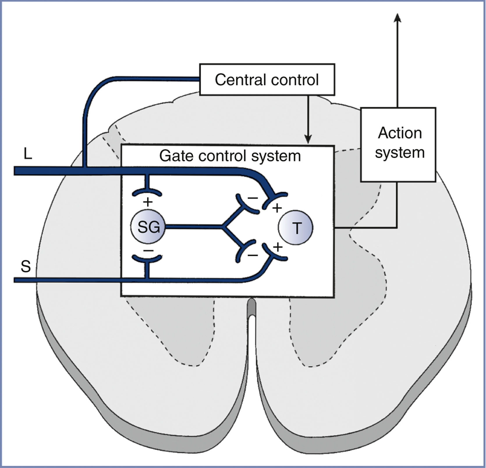 An illustration shows a gate control system inside a cross-section of the spinal cord, with labeled inputs from large and small afferents and pathways to central and action systems.