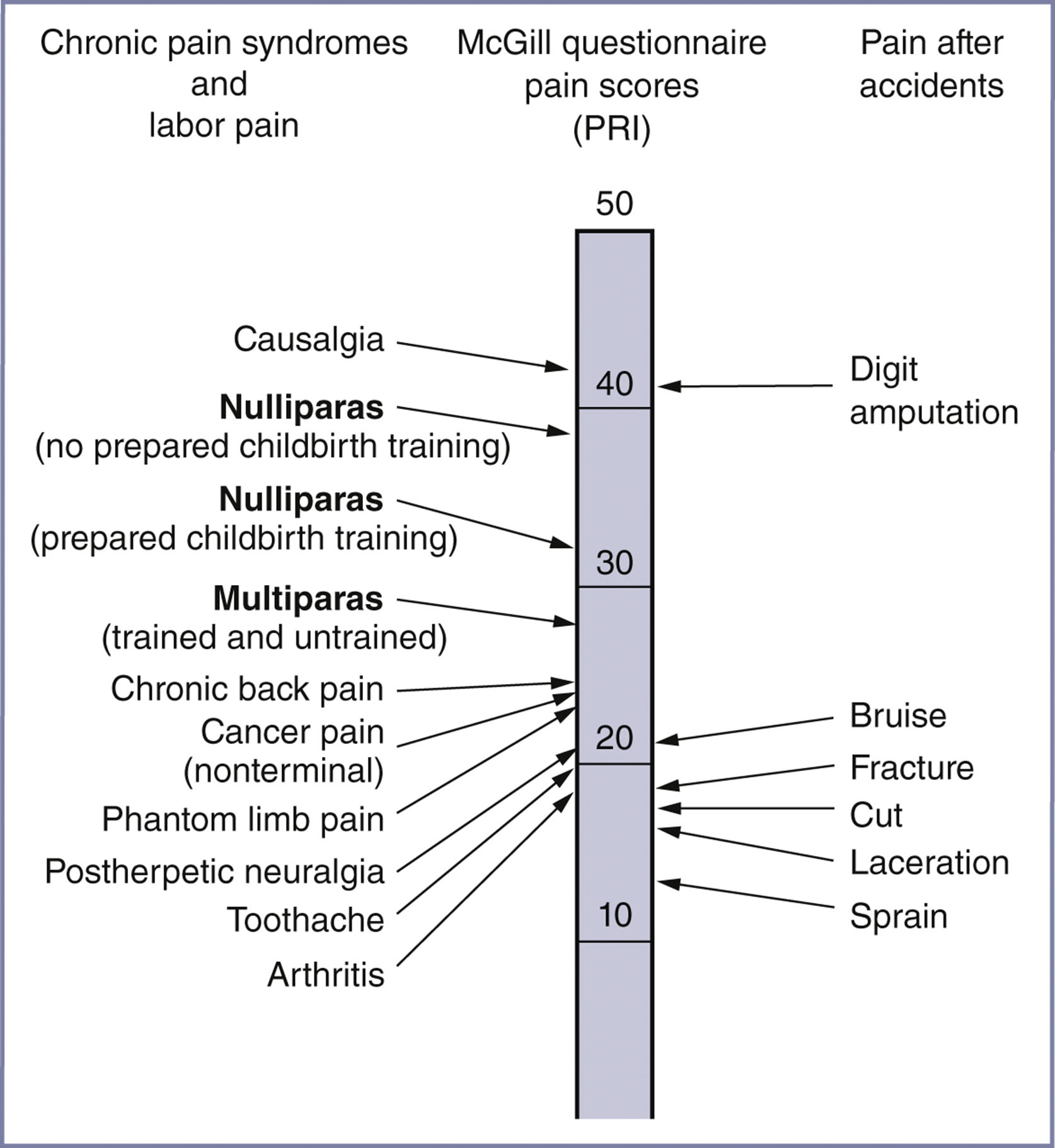 A vertical bar graph compares pain scores from the McGill questionnaire across chronic conditions, labor, and accidents.