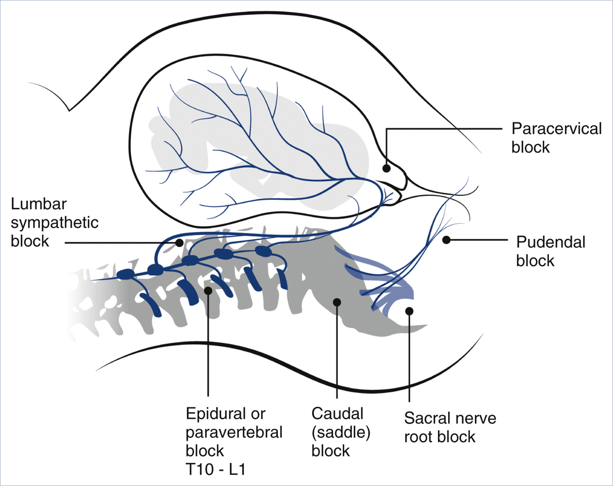 A diagram shows multiple nerve block sites for labor pain, including paracervical, pudendal, caudal, and epidural blocks.