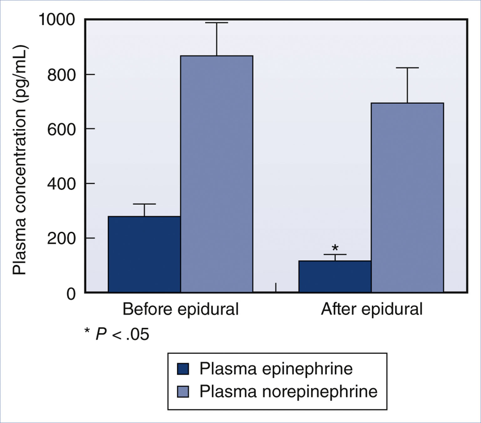 A bar graph compares plasma epinephrine and plasma norepinephrine concentrations before and after epidural administration.