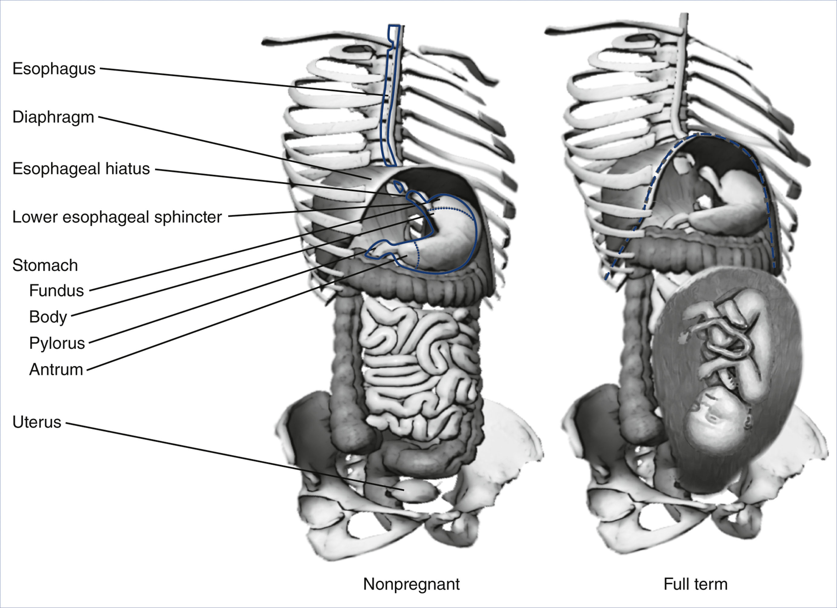 A paired anatomical view shows abdominal organs in nonpregnant and full-term pregnant states with labeled structures.