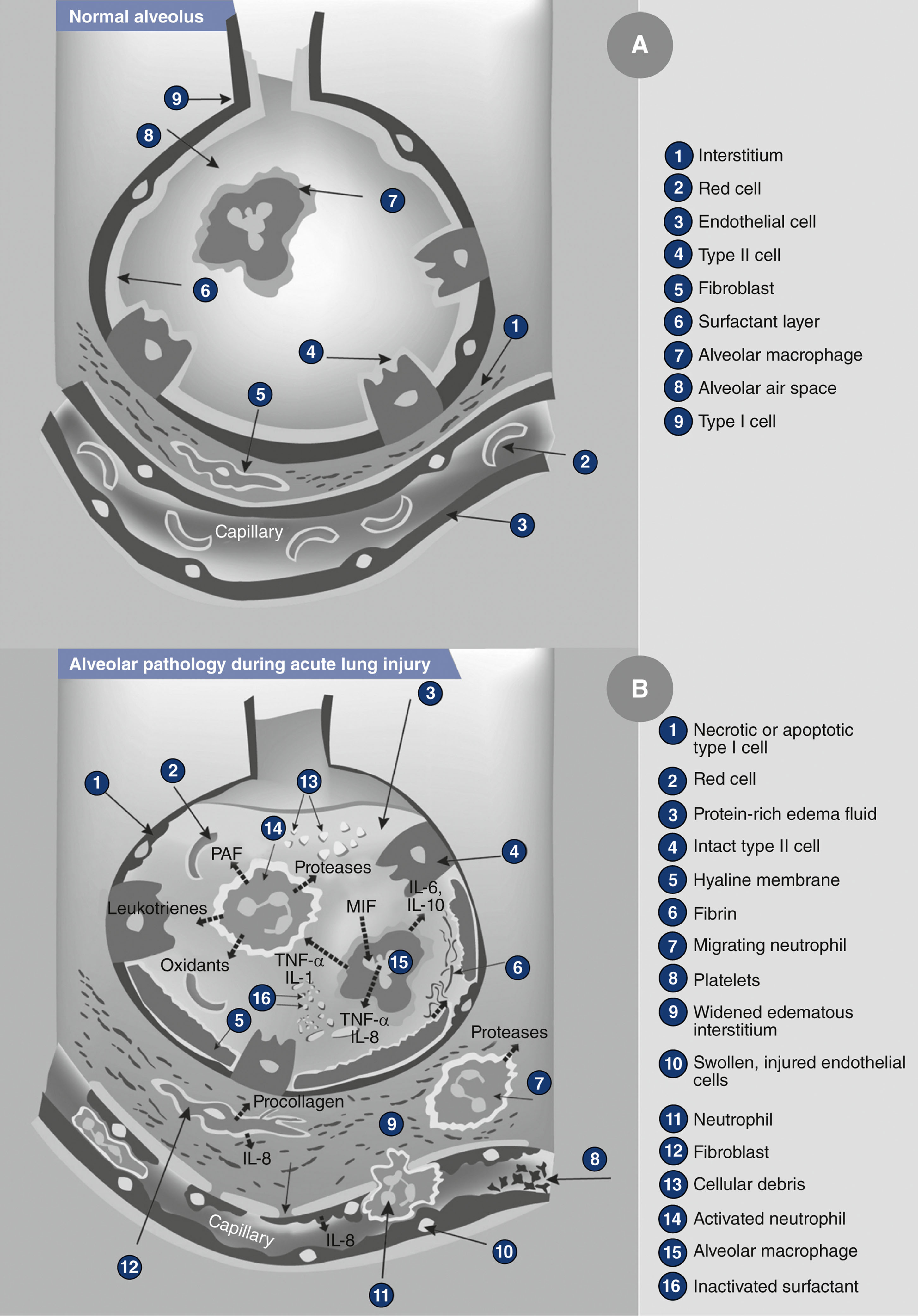 A pair of illustrations shows a normal alveolus and an alveolus with acute lung injury, with labeled cellular and structural components.
