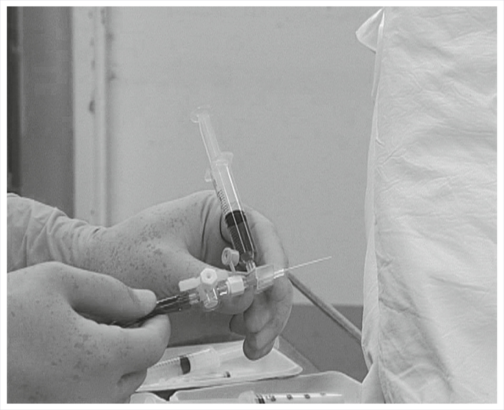A photograph shows a pair of gloved hands holding a syringe connected to a cannula and tubing setup for delivering topical airway anesthesia.