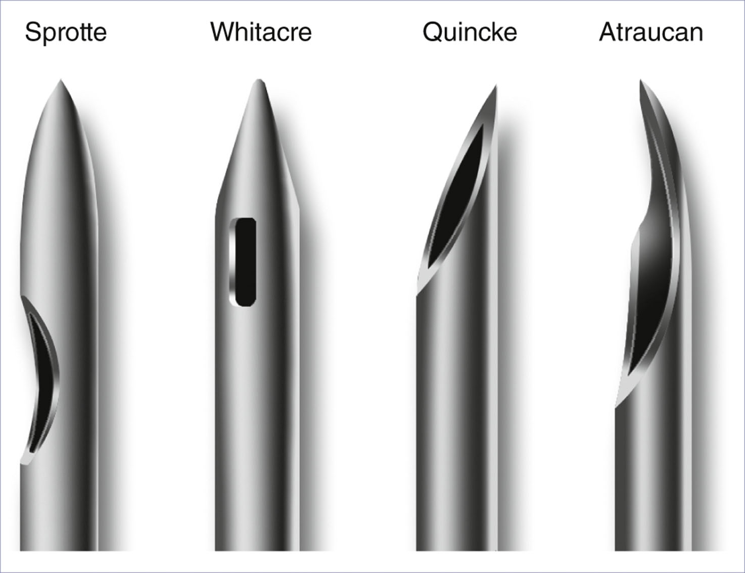 A set of four spinal needle tips labeled Sprotte, Whitacre, Quincke, and Atraucan.