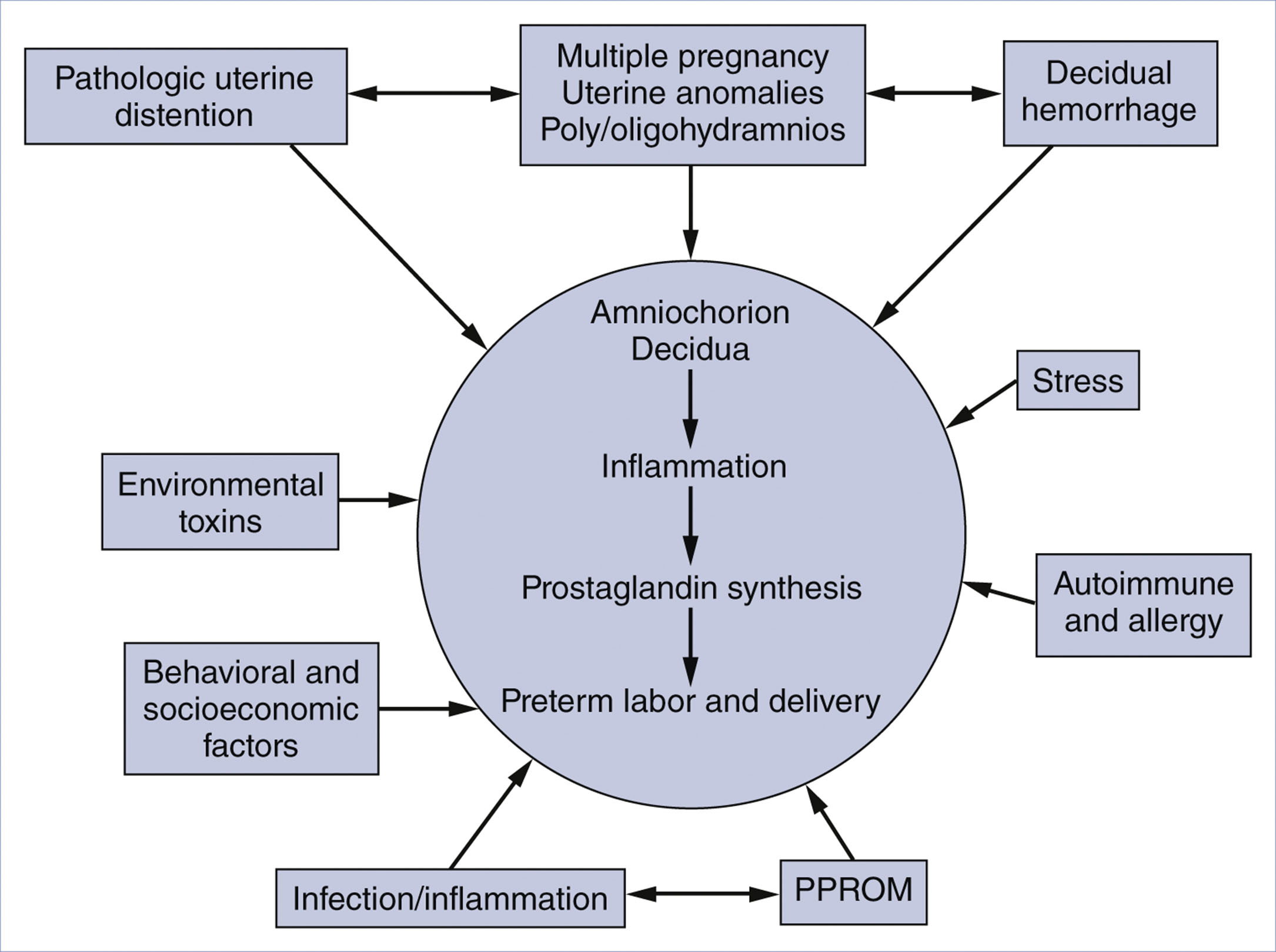 A diagram shows factors leading to preterm labor and delivery through inflammation pathways.