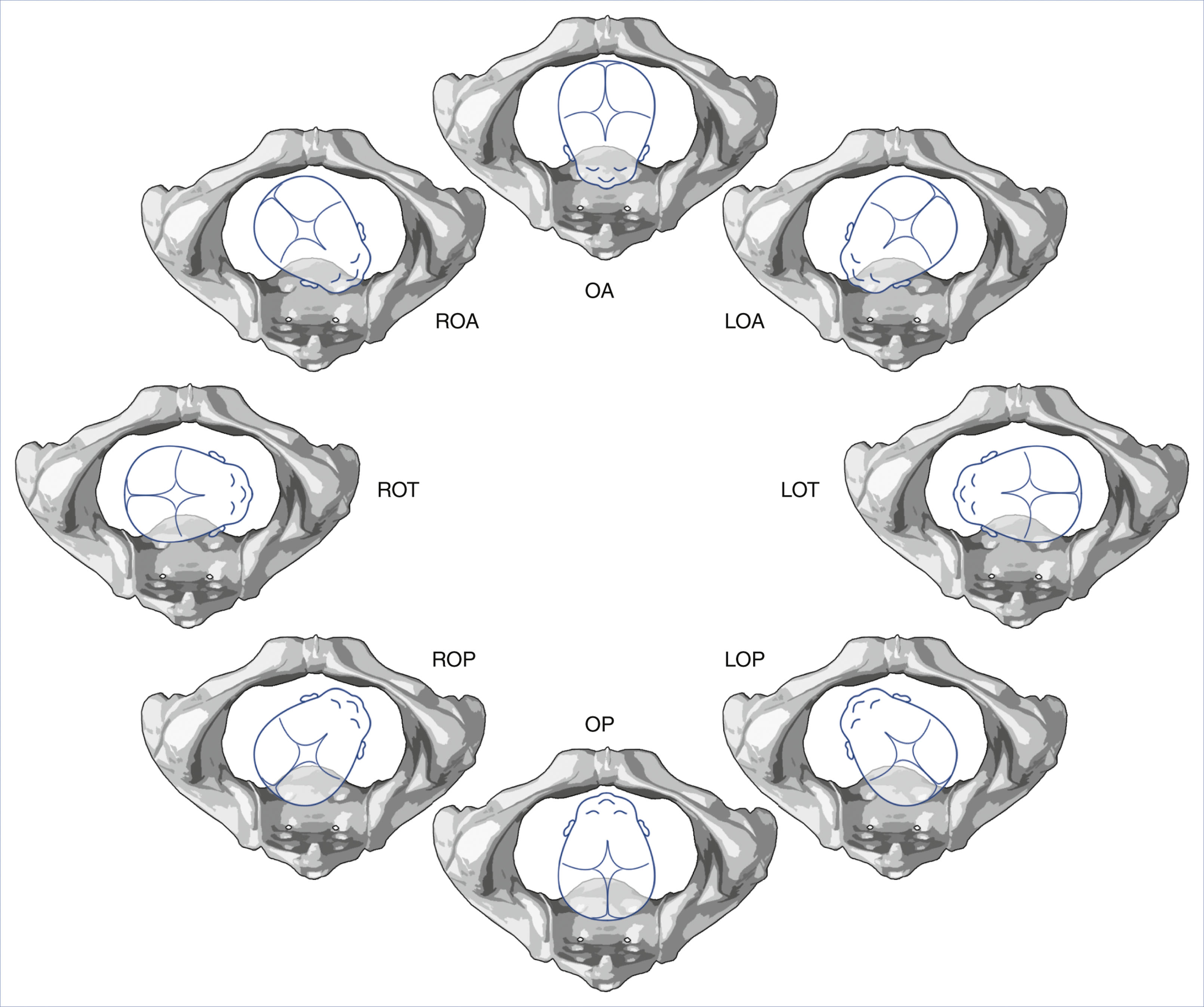 An illustration shows eight fetal head positions in the maternal pelvis labeled with occiput orientations.