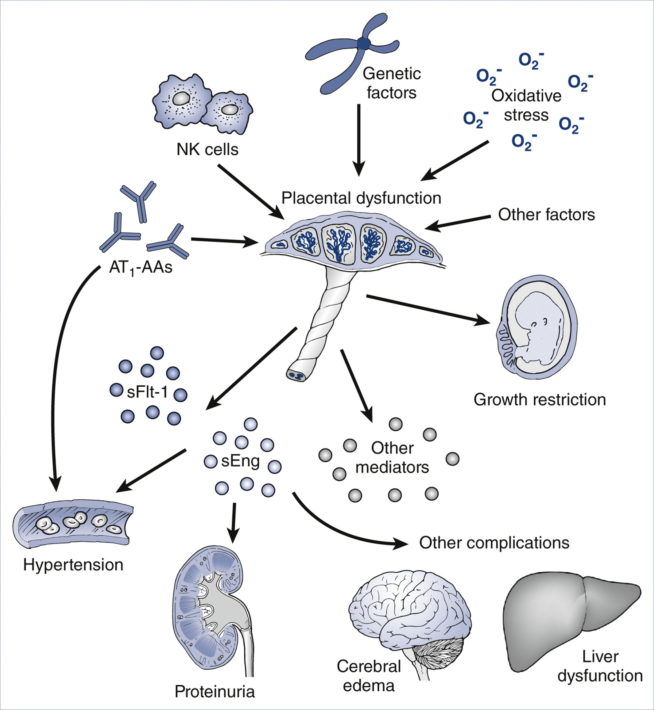 A diagram illustrates the causes and effects of placental dysfunction in preeclampsia, including genetic, immune, and oxidative factors.