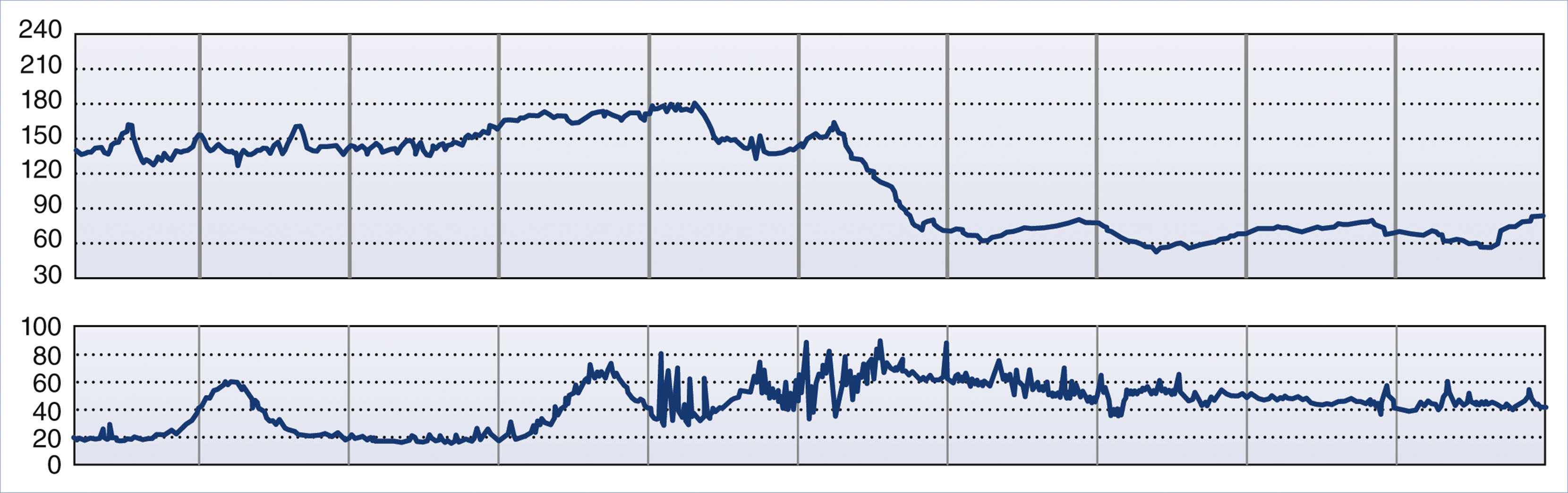 A dual-line graph shows fetal heart rate and uterine activity with a sharp drop in heart rate and onset of uterine tachysystole.