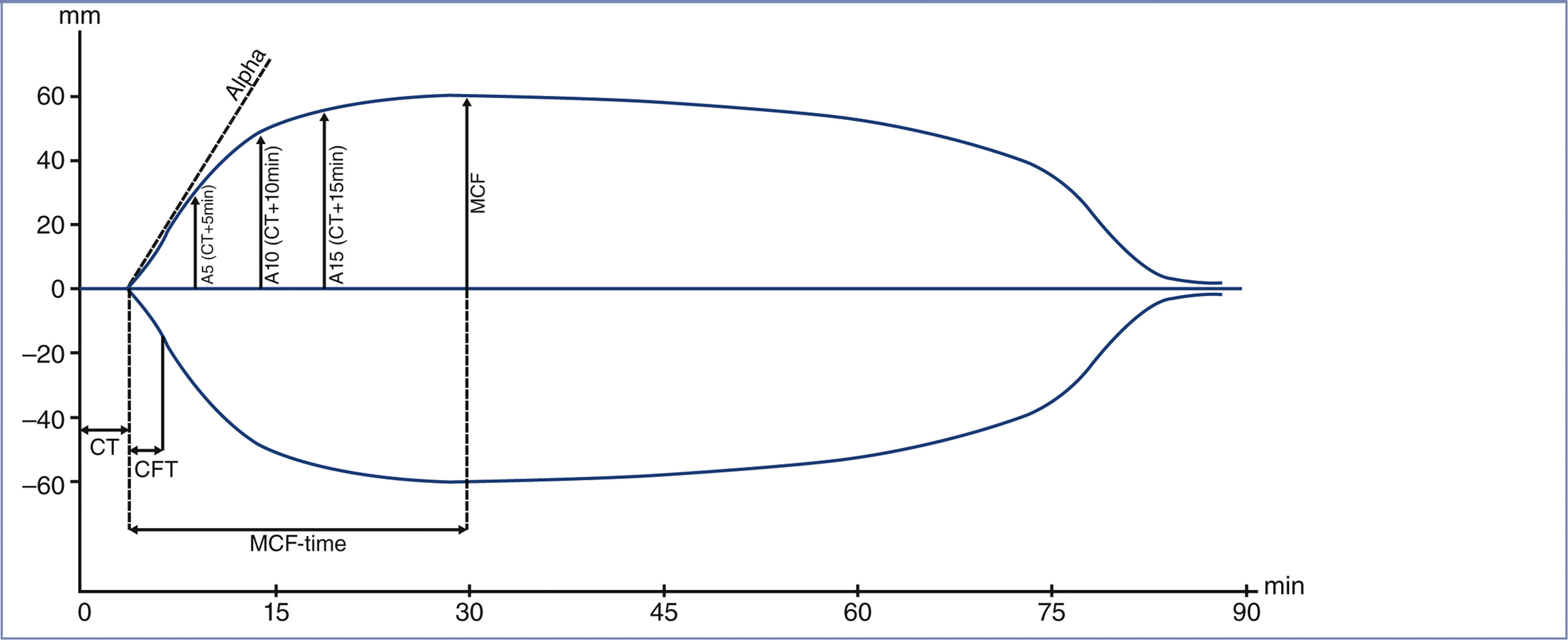 A thromboelastometric tracing shows a symmetric curve with labeled clotting parameters including clotting time, clot formation time, alpha angle, amplitude values, and maximum clot firmness.